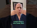 Download Lagu Lymphatic Cleanse Reset!  Dr. Mandell