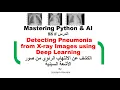 Python Detecting Pneumonia from X ray Images