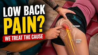 Say Goodbye to Back Pain Adhesion Release Treatment