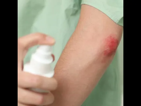 Eau Thermale Avène – Cicalfate+ Spray asséchant réparateur