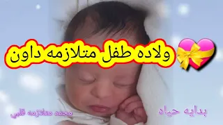 ولاده طفل متلازمه داون افضل نعمه 