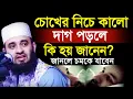 Download Lagu চোখের নিচে কালো দাগ পড়লে কি হয় জানেন, মিজানুর রহমান আজহারী, mizanur Rahman azhari