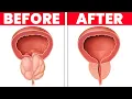 Drink 1 CUP PER DAY to Shrink an Enlarged Prostate