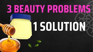 Glow-Up At Home With Vaseline: Soft Lips & Ultra-Smooth Feet | HerZindagi