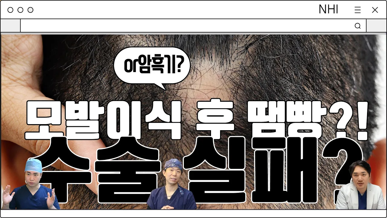 모발이식하고 생긴 땜빵, 수술 실패일까요? 암흑기와 어떻게 구별할까요?│뉴헤어