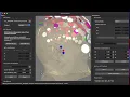 MNE-Python Tutorial on Coregistering EEG Digitization Points with an MRI