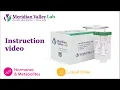 24-Hour Urine How To Collect Your Specimen Instructional