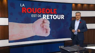 La Rougeole N Est Plus éliminée Au Canada Ce Que Vous Devez Savoir 