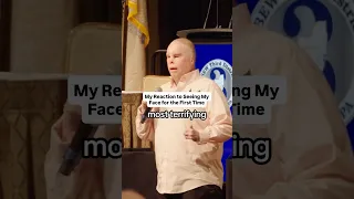 My Reaction to Seeing My Face for the First Time with Rick Yarosh Retired Army Sergeant