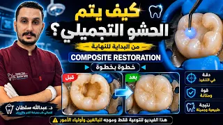 ترميم الضرس بالكومبوزيت بعد حشو العصب| Composite Restoration After Root Canal Treatment Step by Step