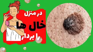 از بین بردن خال با روغن کرچک معجزه ی برداشتن خال ها با روغن کرچک 