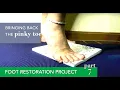 Foot Health Kit Restoration Experiment 7 Pinky Toe strength and arch building