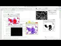 Blood Cancer Detection Using Matlab Project with Source Code Final Year Project Leukemia Detection