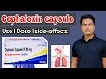 Cephalexin capsules l how it works what are uses