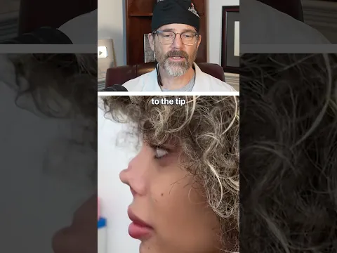 Rhinoplasty Gone WRONG 👃Surgeon Reacts
