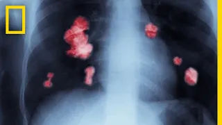 Cancer 101 National Geographic 