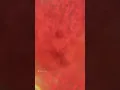 Download Lagu Human cell under microscope😯 || under microscope video 😮