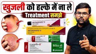 खुजली के प्रकार | Treatment | Medicine | Cream | Fungal Cream | Fungal Infection | Skin Infection 