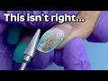 Download Lagu Gel Ruined Her Nails?! The Damage I Found Underneath
