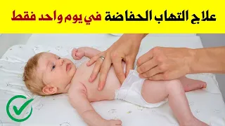 علاج التهاب الحفاضة عند الرضع نهائيا في يوم واحد فقط و في البيت 👍