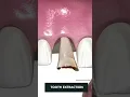 Download Lagu Tooth Implant Procedure {STEP BY STEP}