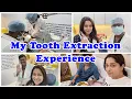 Download Lagu Finally I got my tooth extracted| Is it painfull or Not? | Dipika Ki Duniya