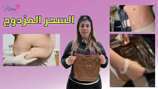 التحدي المزدوج لنسف الكرش والبطن المتدلية