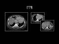 Hepatic Emergencies Interesting Radiology Cases
