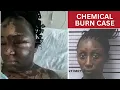 Jury convicts Georgia woman of first-degree assault in Mobile County chemical burn case