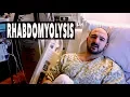 My Son Was Hospitalized for 6 Days Rhabdomyolysis HIS STORY Dr Paul