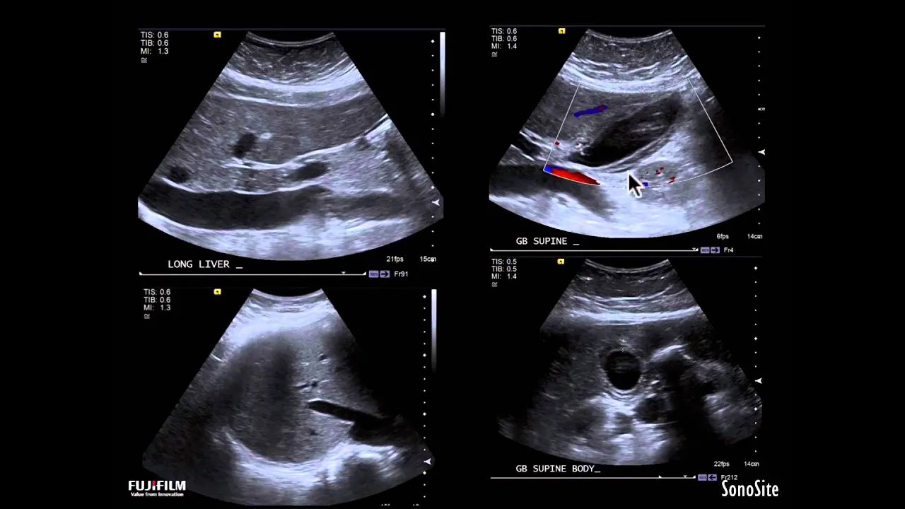 Webinar: Point-of-Care Ultrasound and the Hospitalist - Does it Matter?