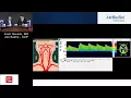 Download Lagu TCD Basics For The Perfusionist  (Zsolt Garami MD) Utilization of TCD for Primary Stroke Prevention