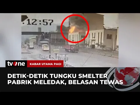 17 Pasien Luka Bakar Sedang Dalam Proses Operasi usai Insiden Meledaknya Tungku Smelter