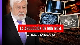 El IMPLANTE EXTRATERRESTRE más DOCUMENTADO del mundo