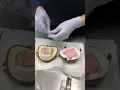 Processing acrylic partial dentures 6