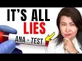 What Your ANA Test Results REALLY Mean For Your Health