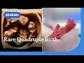 Queensland woman gives birth to identical quadruplets after one in 15 million pregnancy ABC NEWS