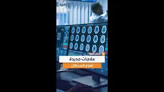 آخر ما توصلت إليه علاجات السرطان تقنيات ذكية وعلاجات موجهة تفتح أبواب الأمل وترفع نسب الشفاء عالميا 