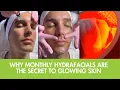 Why Monthly Hydrafacials Are the Secret to Glowing Skin 4Ever Young Fleming Island