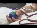 BPL Plasma launches program to help search for possible COVID-19 treatment