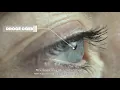 Download Lagu Bausch + Lomb ULTRA for Astigmatism (NL)