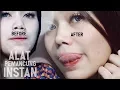 ALAT PEMANCUNG HIDUNG INSTAN TANPA OP EPS 01 PEMANCUNG HIDUNG PPOS