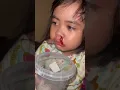 Download Lagu Anak kecil panas tinggi dan mimisan