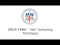 EBUS-TBNA Jab Sampling Technique