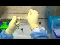 13 Demonstration of liquid culture method for diagnosis of tuberculosis in sputum