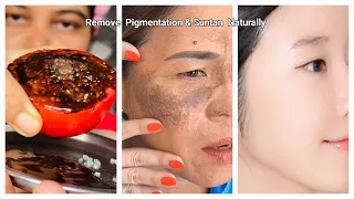 Clean Pigmentation,Dark Spots & Tanning In 7Days 