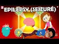 Download Lagu What Causes Epilepsy? | Seizures Explained | The Dr Binocs Show | Peekaboo Kidz