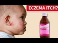 Calamine for Eczema Itch