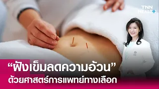 การฝังเข็มช่วยลดน้ำหนักได้จริงหรือไม่ และทำให้น้ำหนักลดอย่างไร
