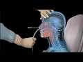Download Lagu How to insert a nasogastric tube for NG intubation - 3d animation